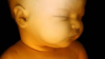 Ultraschallbilder-Schwangerschaft