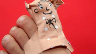 In welchen Fällen wird ein Finger- oder Fußnagel entfernt?