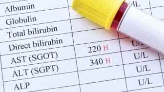 Alanin-Aminotransferase (ALT/GPT)