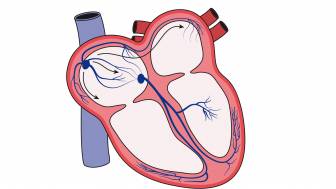 Was ist der AV-Knoten?