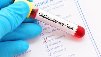 Cholinesterase