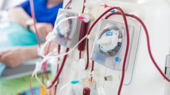 Nierenversagen: Lebensretter Dialyse