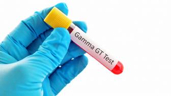 Gamma-GT