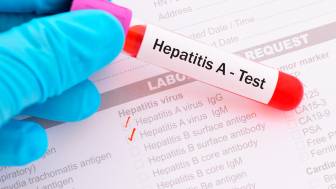 Hepatitis A