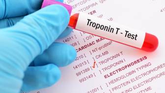 Wie funktioniert ein Test oder Schnelltest bei einem Herzinfarkt?