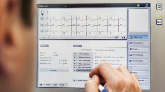 Batteriewechsel beim Herzschrittmacher – wann ist es notwendig und wie läuft es ab?