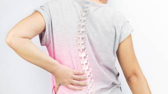 Was ist eine lumbale Spondylose?