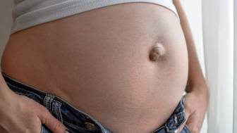Wie entsteht ein Nabelbruch in der Schwangerschaft und wie wird er behandelt?