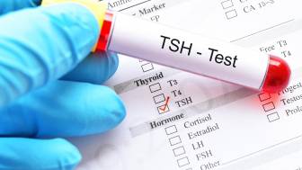 Wie funktioniert ein Test auf eine Schilddrüsenunterfunktion?