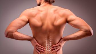 Spondylose / Spondylosis deformans