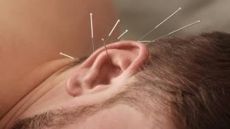 Inwiefern hilft Akupunktur bei Tinnitus?