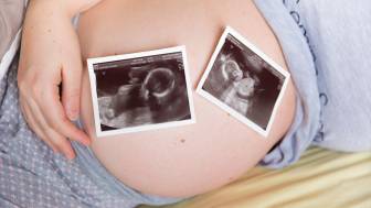 Weshalb wird ein Früher Totaler Muttermundverschluss bei Mehrlingsschwangerschaften empfohlen?