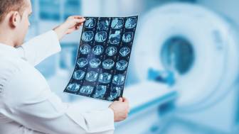 Inwiefern kann ein MRT eine Trigeminusneuralgie sichtbar machen?