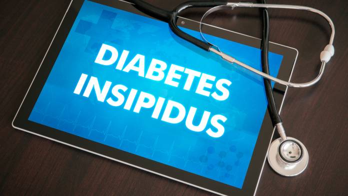 Diabetes insipidus