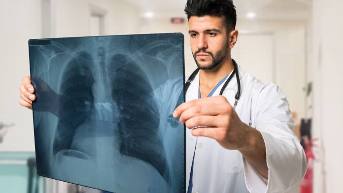 Lungentransplantation: Lungenfribrose häufigster Grund