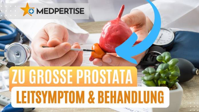 Zu große Prostata - Leitsymptom und Behandlung (Prof. Dr. Lutz Trojan) #prostatavergrößerung