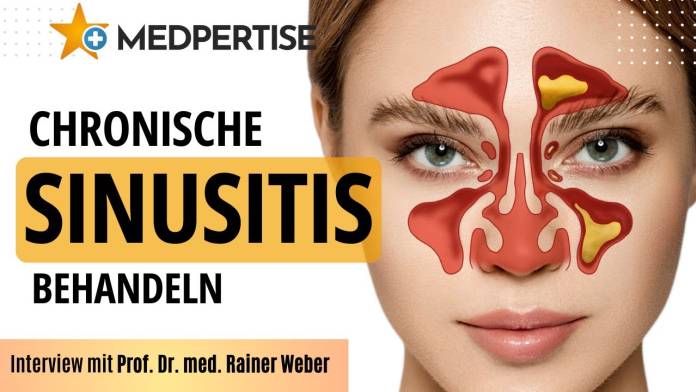 Nasennebenhöhlenentzündung: OP oder nicht? Tipps von Prof. Dr. med. Rainer Weber