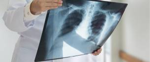 Was Ist Ein Iatrogener Pneumothorax Und Wie Kann Das Passieren