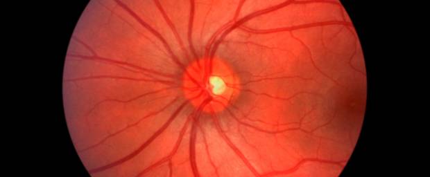 Wie Lange Dauert Eine Angiographie Am Auge www.medpertise.de