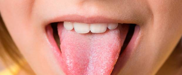 Angeschwollen der zunge Belegte Zunge