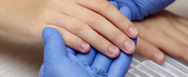 Kind mit brüchigen Fingernägeln beim Arzt