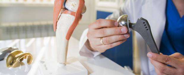 Arzt hält künstliche Hüftprothese in der Hand