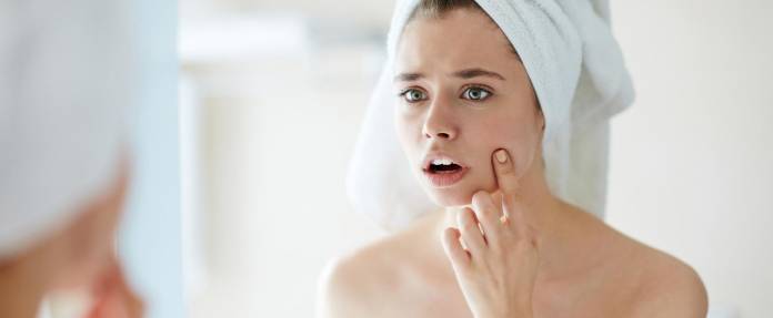 Junges Mädchen zeigt erschrocken auf einen Pickel auf der Wange