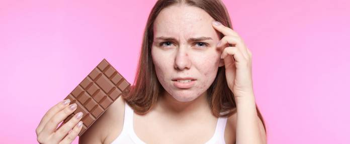 Junges Mädchen mit unreiner Haut und Tafel Schokolade in der Hand schaut skeptisch