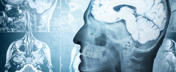 Röntgenaufnahme vom Kopf, Gehirn