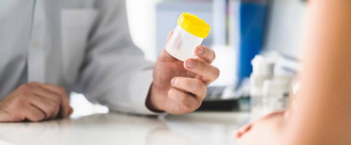 Patient bei Arzt, der eine Urinprobe in der Hand hält