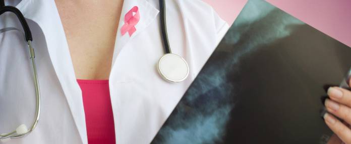 Gynäkologin mit Mammographie-Befund