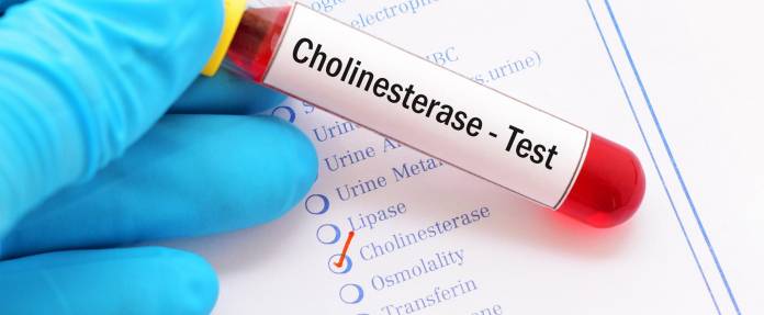 Colinesterase-Test