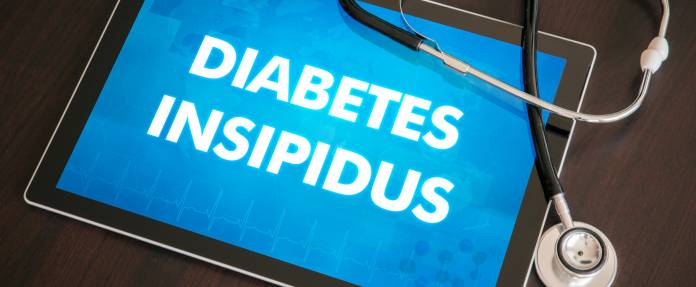 Diabetes insipidus