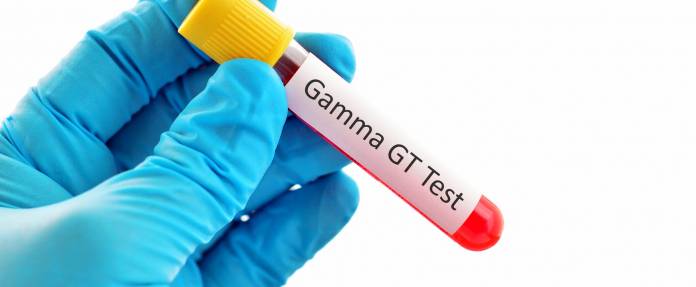 Gamma-GT Test