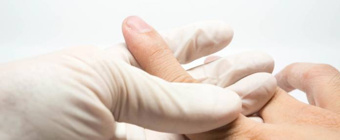 Arzt mit Handschuhen untersucht Finger