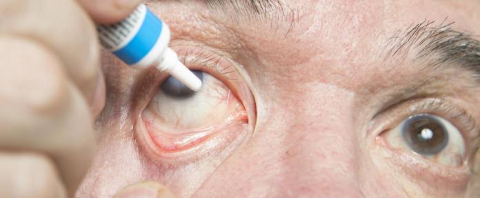 Mann mit Grünem Star tropft sich Augentropfen ins betroffene Auge