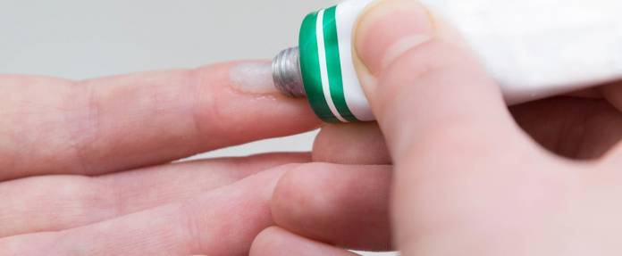 Salbenstrang wird aus Tube auf den Zeigefinger gedrückt