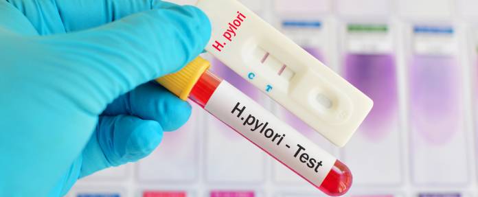 Test auf Helicobacter pylori-Bakterien