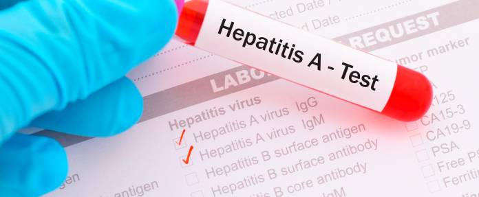 Hepatitis A