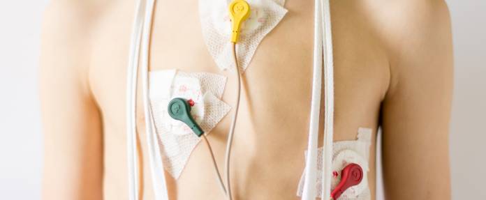 Kind mit Herz-EKG - Elektroden am Oberkörper
