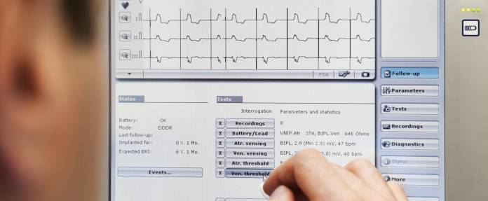 Batteriewechsel beim Herzschrittmacher – wann ist es notwendig und wie läuft es ab?