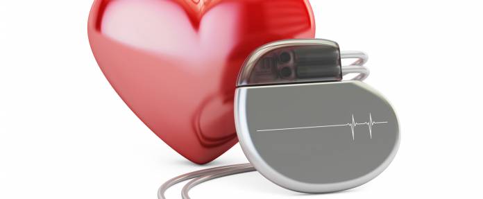 Herzschrittmacher vor Herz