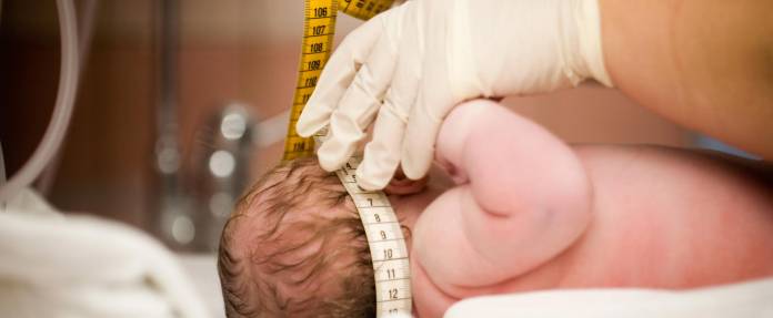 Einem Neugeborenem wird der Kopf vermessen mit einem Massband