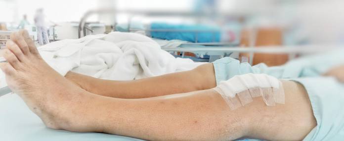 Patient nach Kniebehandlung im Krankenbett