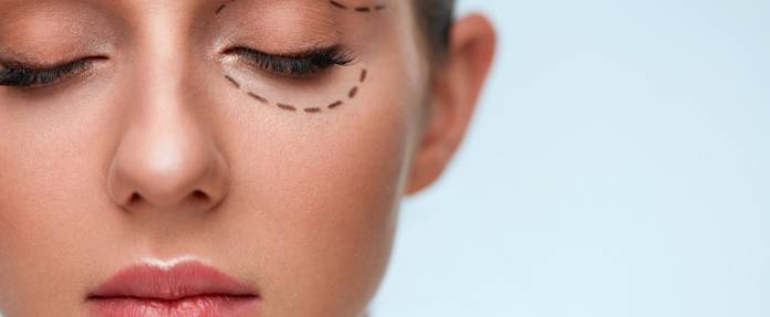 Tränensäcke entfernen