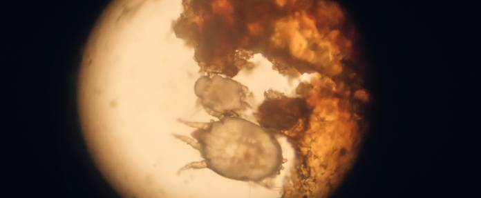 Kratzmilbe unter Mikroskop