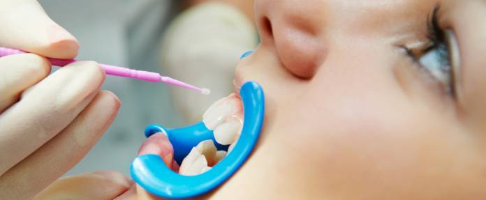 Kind bei Zahnversiegelung