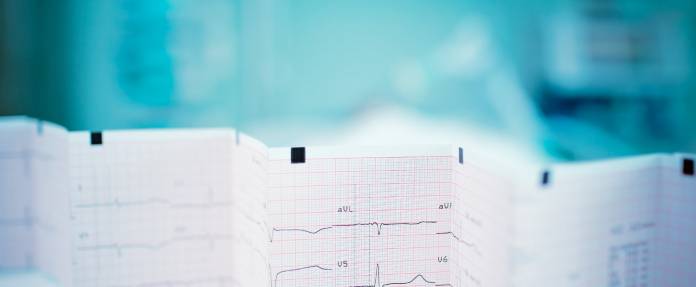 Langzeit-EKG