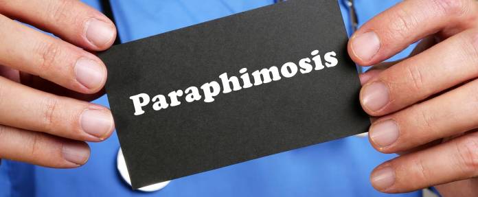 Arzt hält Schild mit Aufschrift Paraphimosis in der Hand