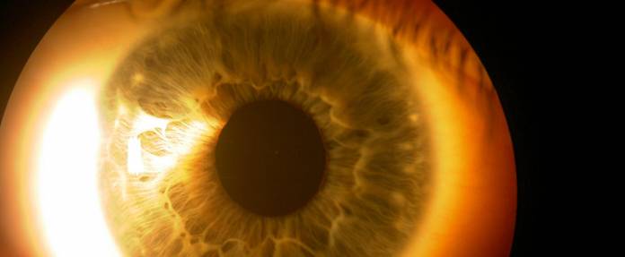 Menschliches Auge wird durch Spaltlampe untersucht